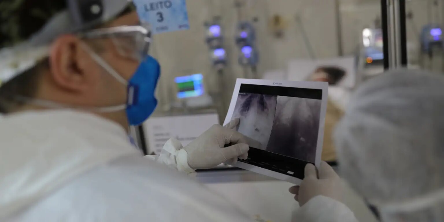 covid-e-principal-causa-de-internacao-por-sindrome-respiratoria-no-rio