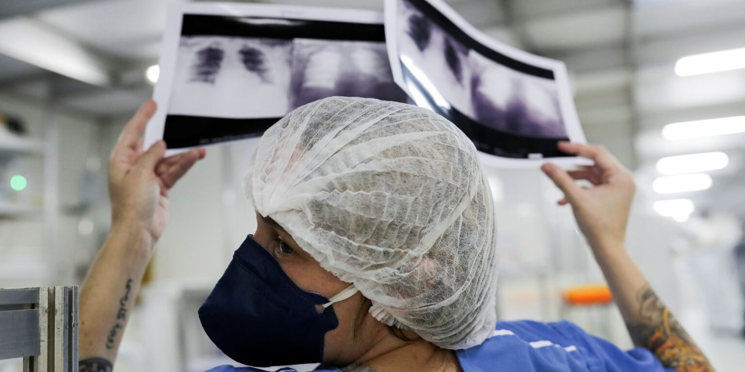 Lei institui campanha para conscientização sobre câncer de pulmão lei-institui-campanha-para-conscientizacao-sobre-cancer-de-pulmao
