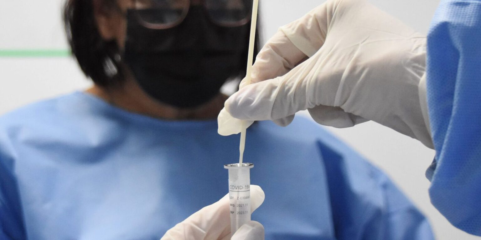 RJ: cenário epidemiológico de covid-19 tem tendência de redução rj:-cenario-epidemiologico-de-covid-19-tem-tendencia-de-reducao