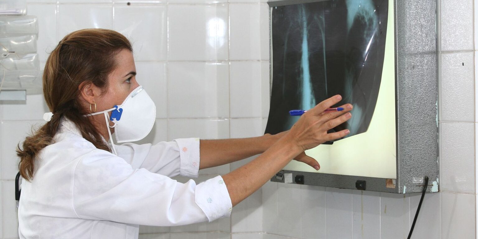 oms-recomenda-testes-de-diagnostico-rapido-para-erradicar-tuberculose