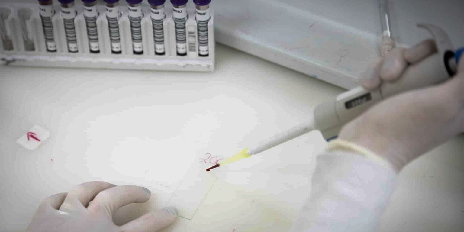 Exames descartam ebola em imigrante da República Democrática do Congo exames-descartam-ebola-em-imigrante-da-republica-democratica-do-congo